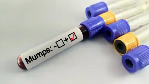 What Foods Should I Eat if I Have Mumps Disease?